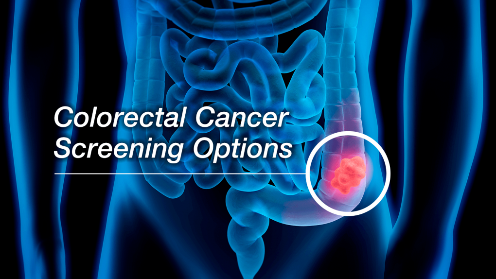 Colon cancer Screening II